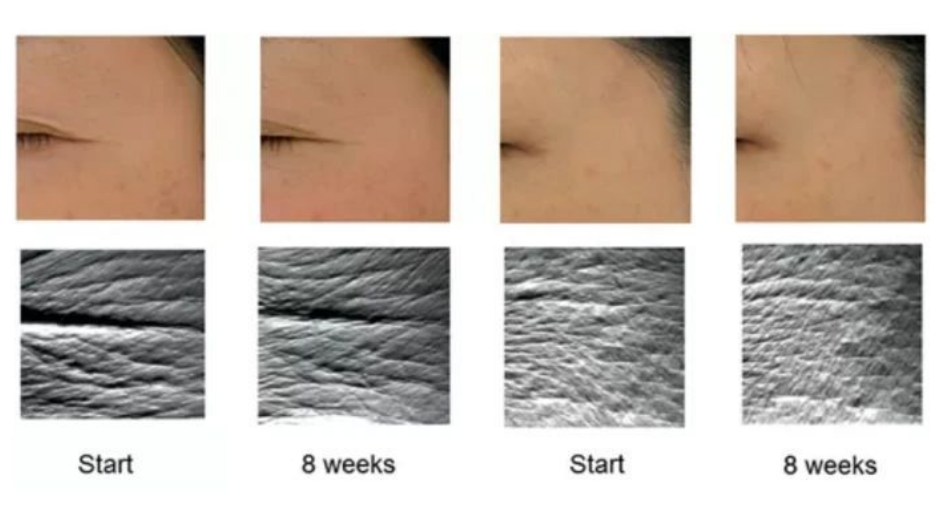 艾詩(shī)特蝦青素