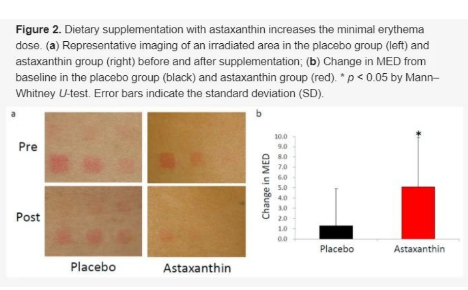 艾詩(shī)特蝦青素