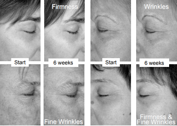 艾詩(shī)特蝦青素