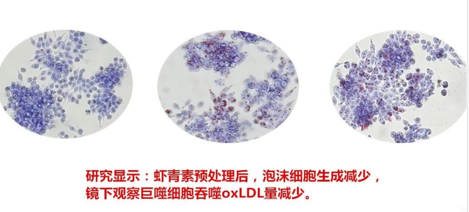 艾詩(shī)特蝦青素