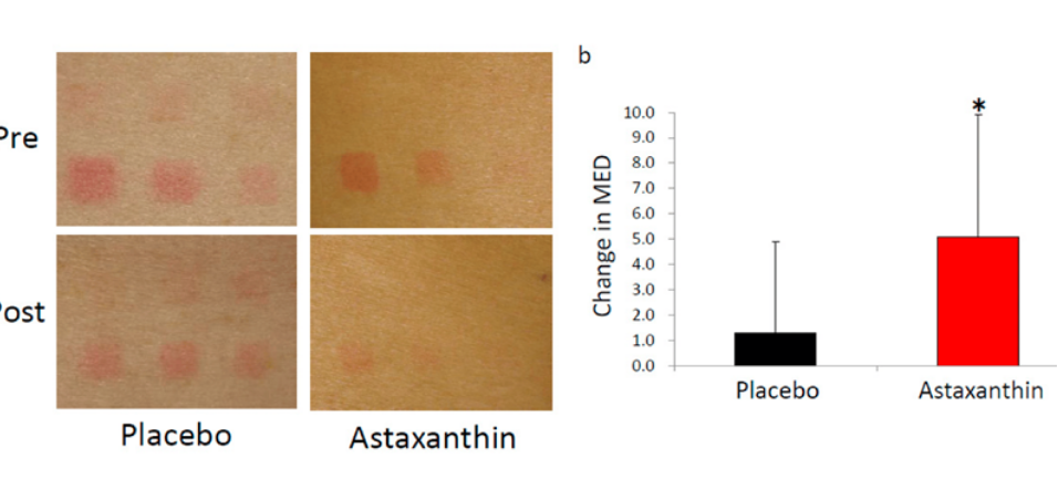 艾詩(shī)特蝦青素