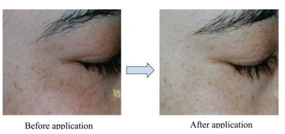 艾詩(shī)特蝦青素