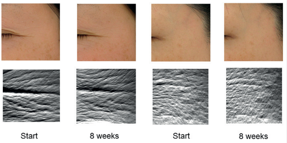 艾詩(shī)特蝦青素