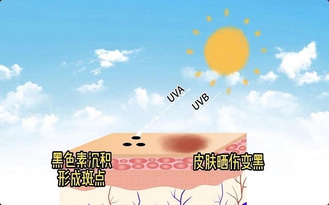 天然蝦青素可以祛斑嗎？